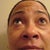 Eyelid Surgery Community Photo